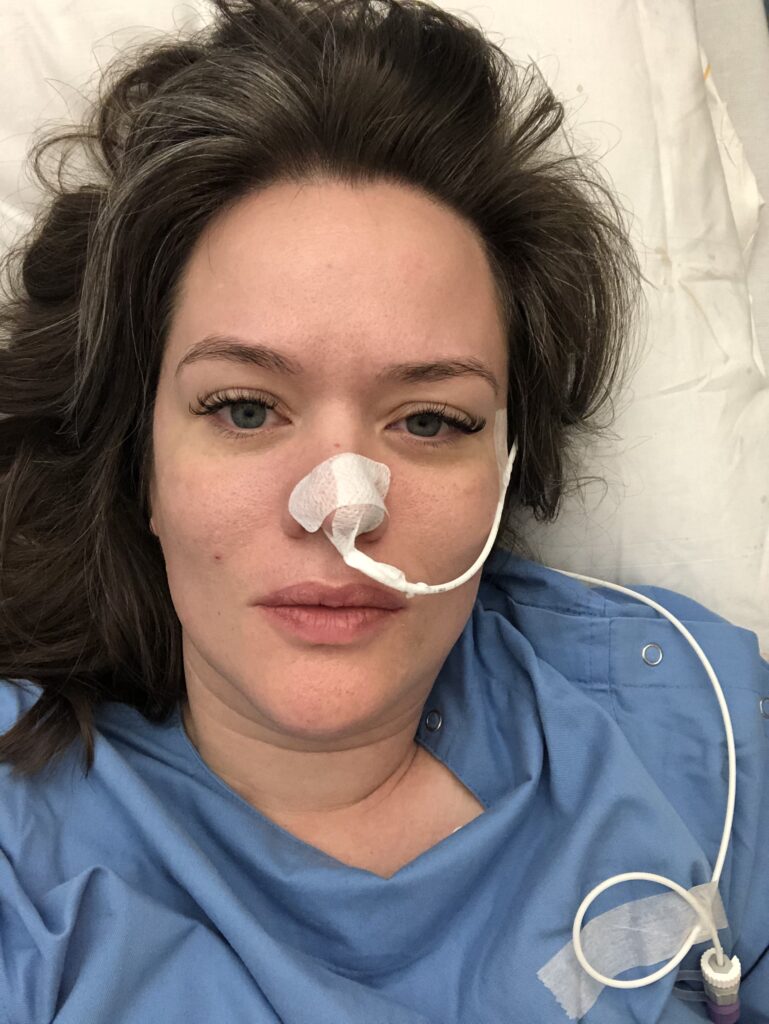 a woman lays in a hospital bed in a blue hospital gown witha feeding tube through her nose